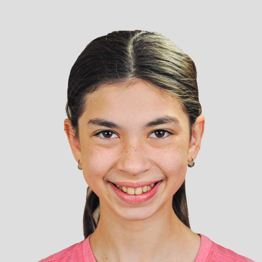 Early Orthodontic Treatment